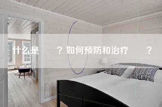 什么是圐圙？如何预防和治疗圐圙？